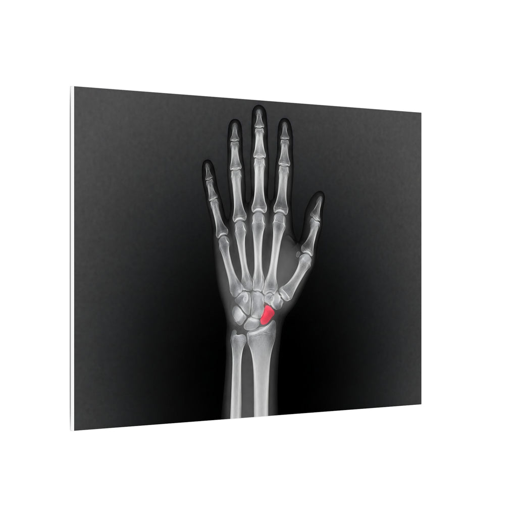 Carpal Study - Doctor's Office Wall Art | Canvas (Landscape)