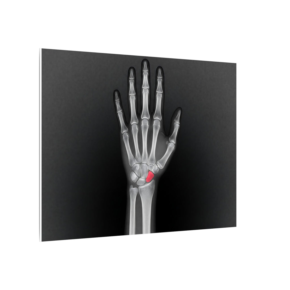 Carpal Study - Doctor's Office Wall Art | Canvas (Landscape)