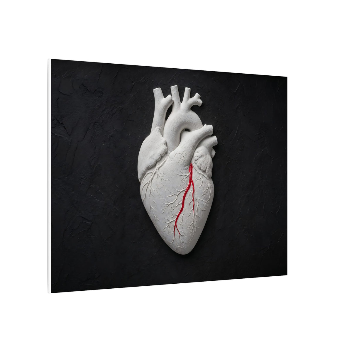 Coronary Path - Doctor's Office Wall Art | Canvas (Landscape)