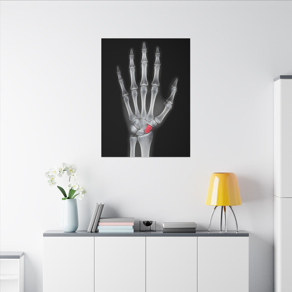 Carpal Study - Doctor's Office Wall Art | Canvas