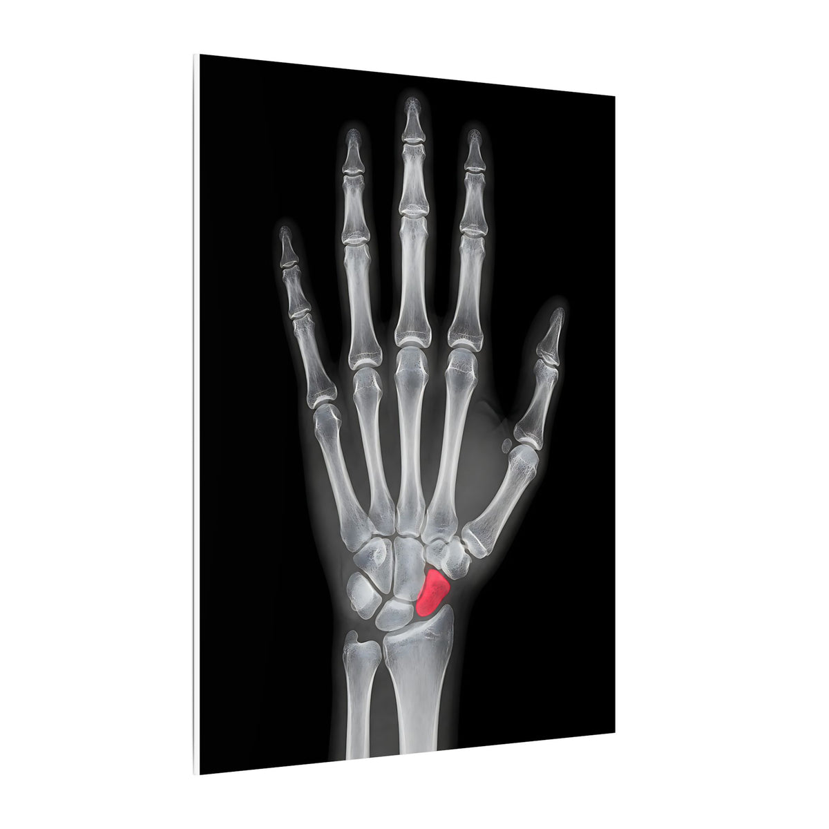 Carpal Study - Doctor's Office Wall Art | Canvas