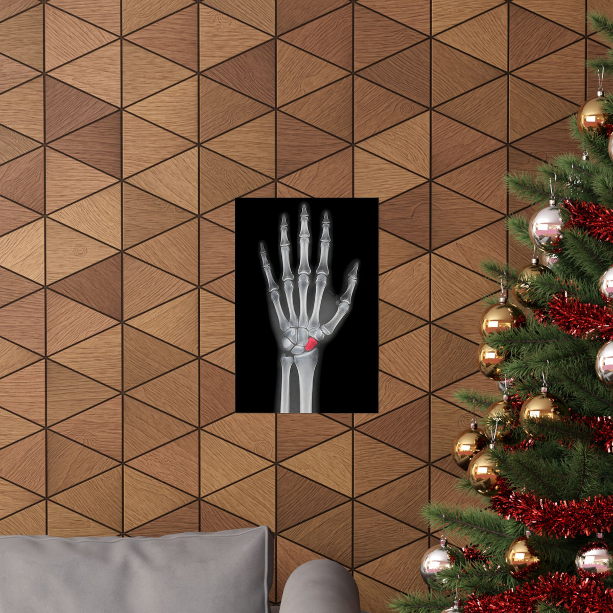 Carpal Study - Doctor's Office Wall Art | Matte Poster