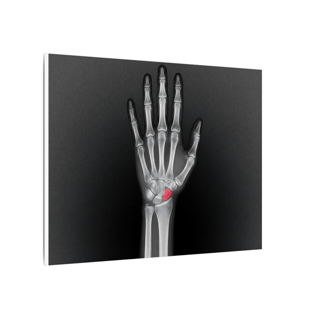 Carpal Study - Doctor's Office Wall Art | Canvas (Landscape)