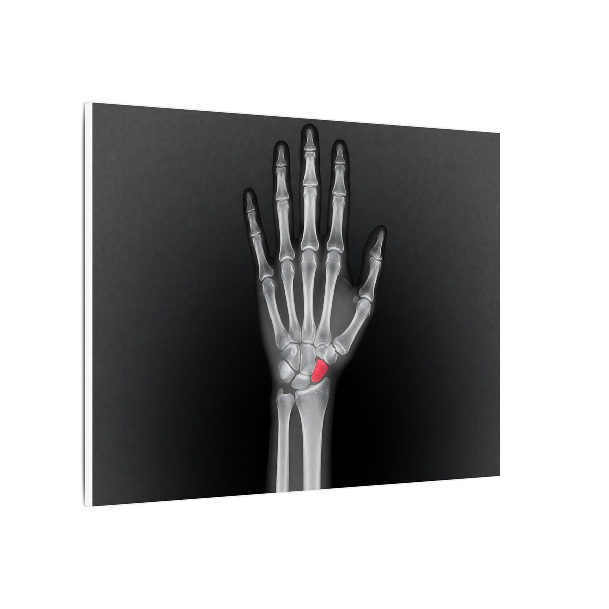 Carpal Study - Doctor's Office Wall Art | Canvas (Landscape)