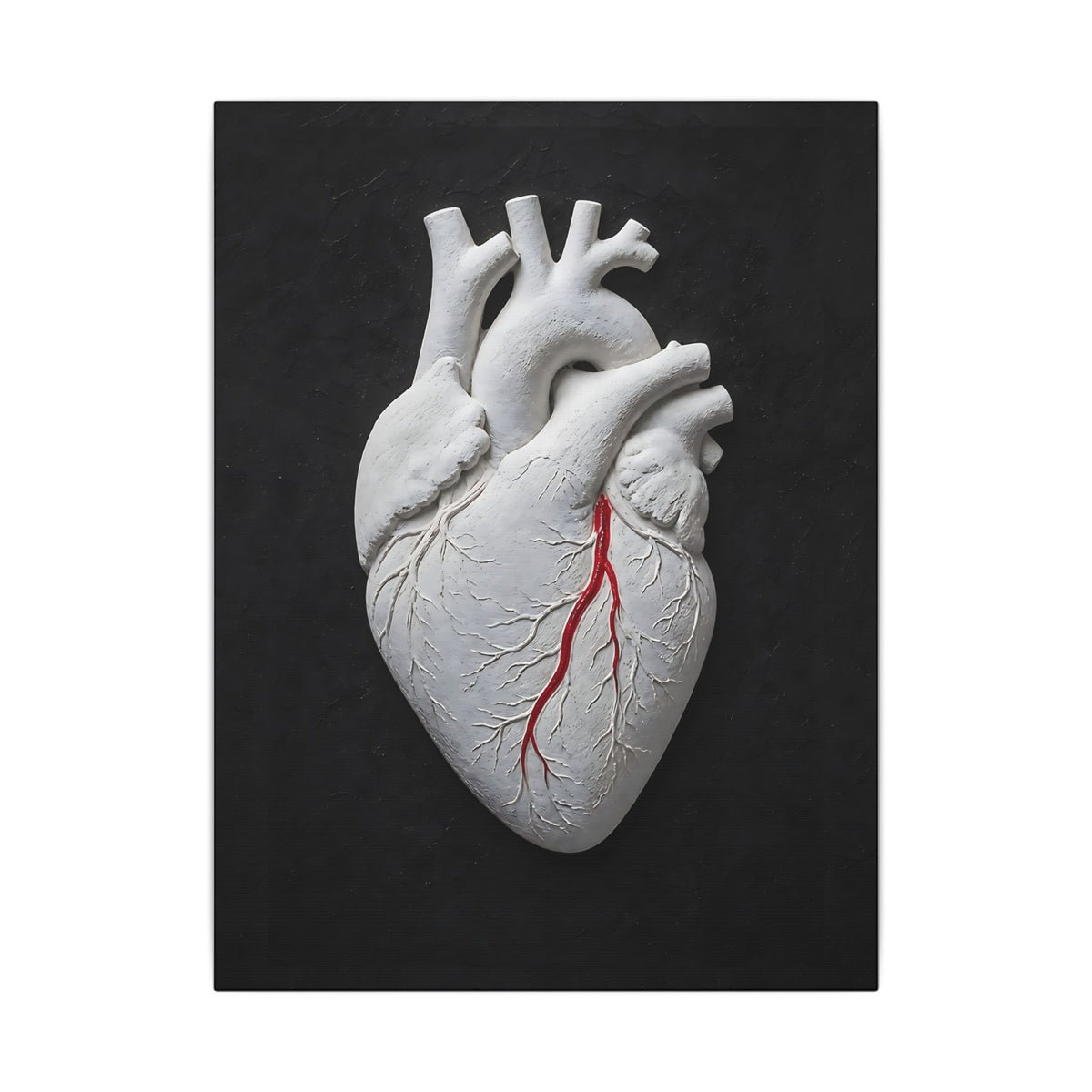 Coronary Path - Doctor's Office Wall Art | Canvas
