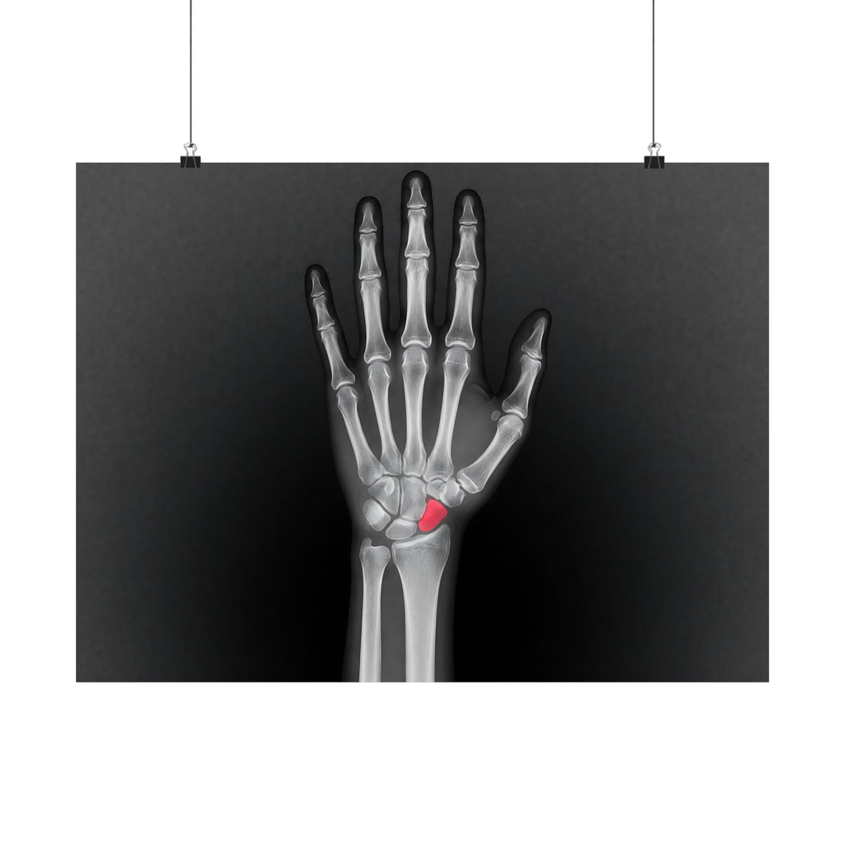 Carpal Study - Doctor's Office Wall Art | Matte Poster (Landscape)