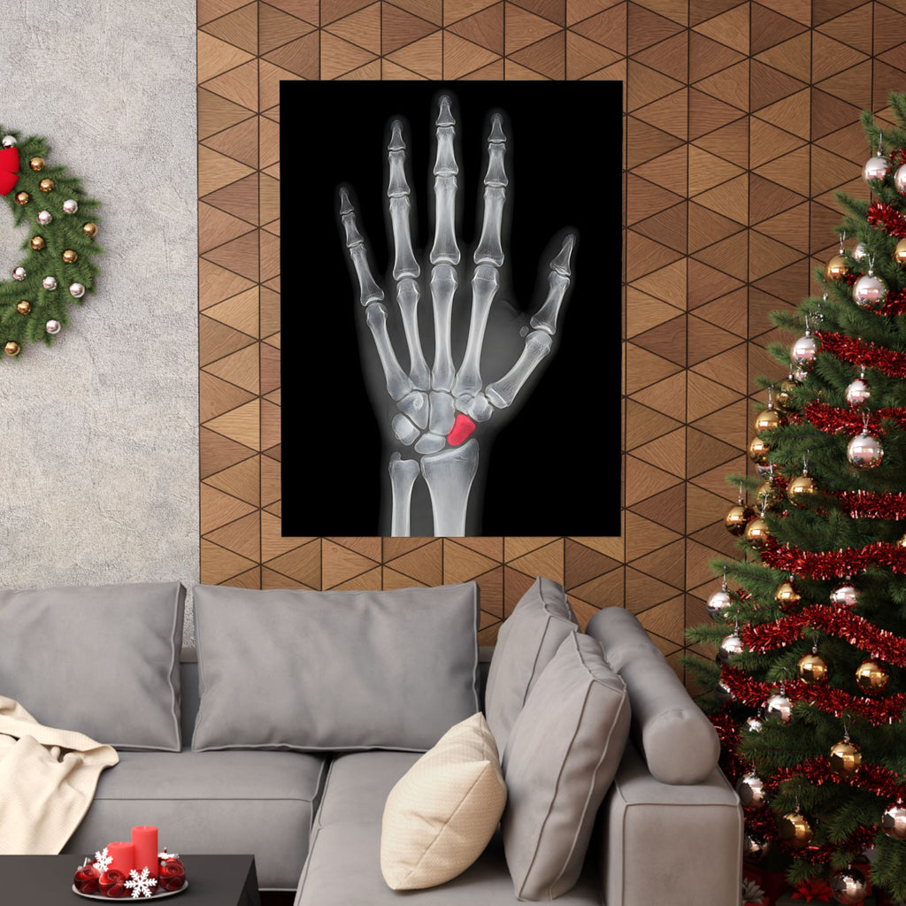 Carpal Study - Doctor's Office Wall Art | Matte Poster