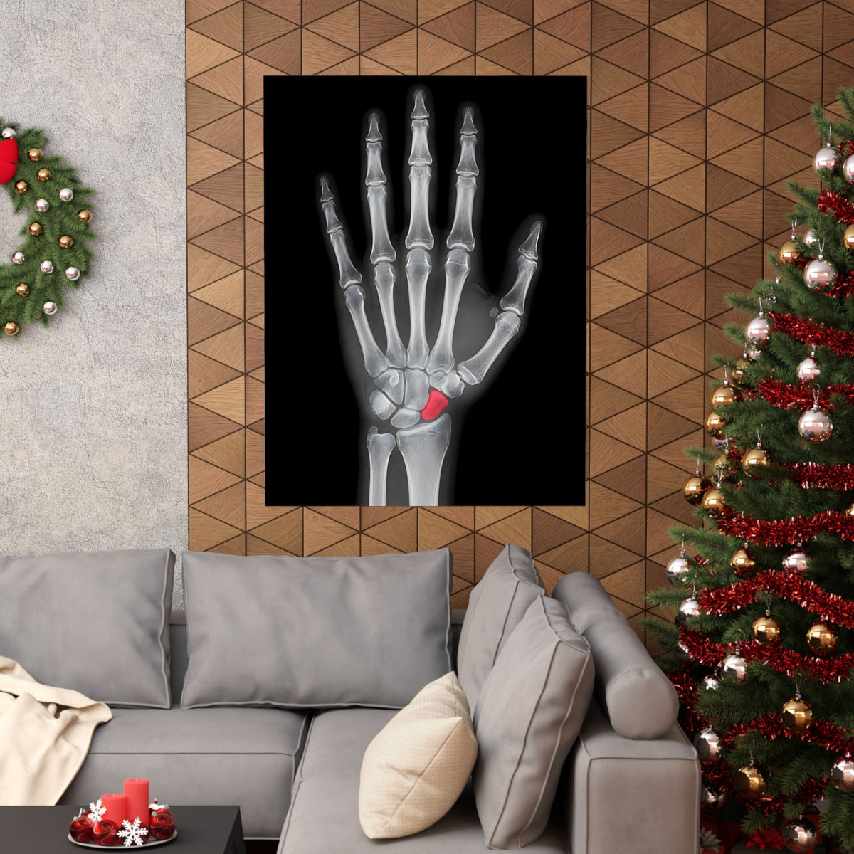 Carpal Study - Doctor's Office Wall Art | Matte Poster