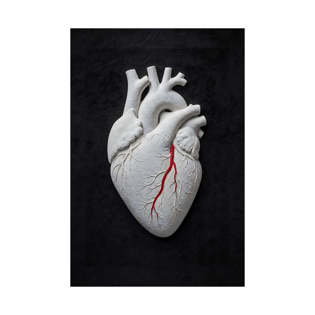 Coronary Path - Doctor's Office Wall Art | Matte Poster