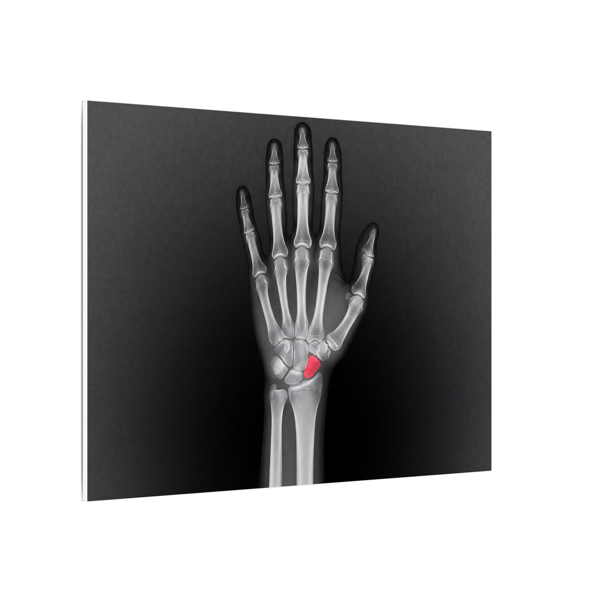 Carpal Study - Doctor's Office Wall Art | Canvas (Landscape)
