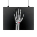 Carpal Study - Doctor's Office Wall Art | Matte Poster (Landscape)