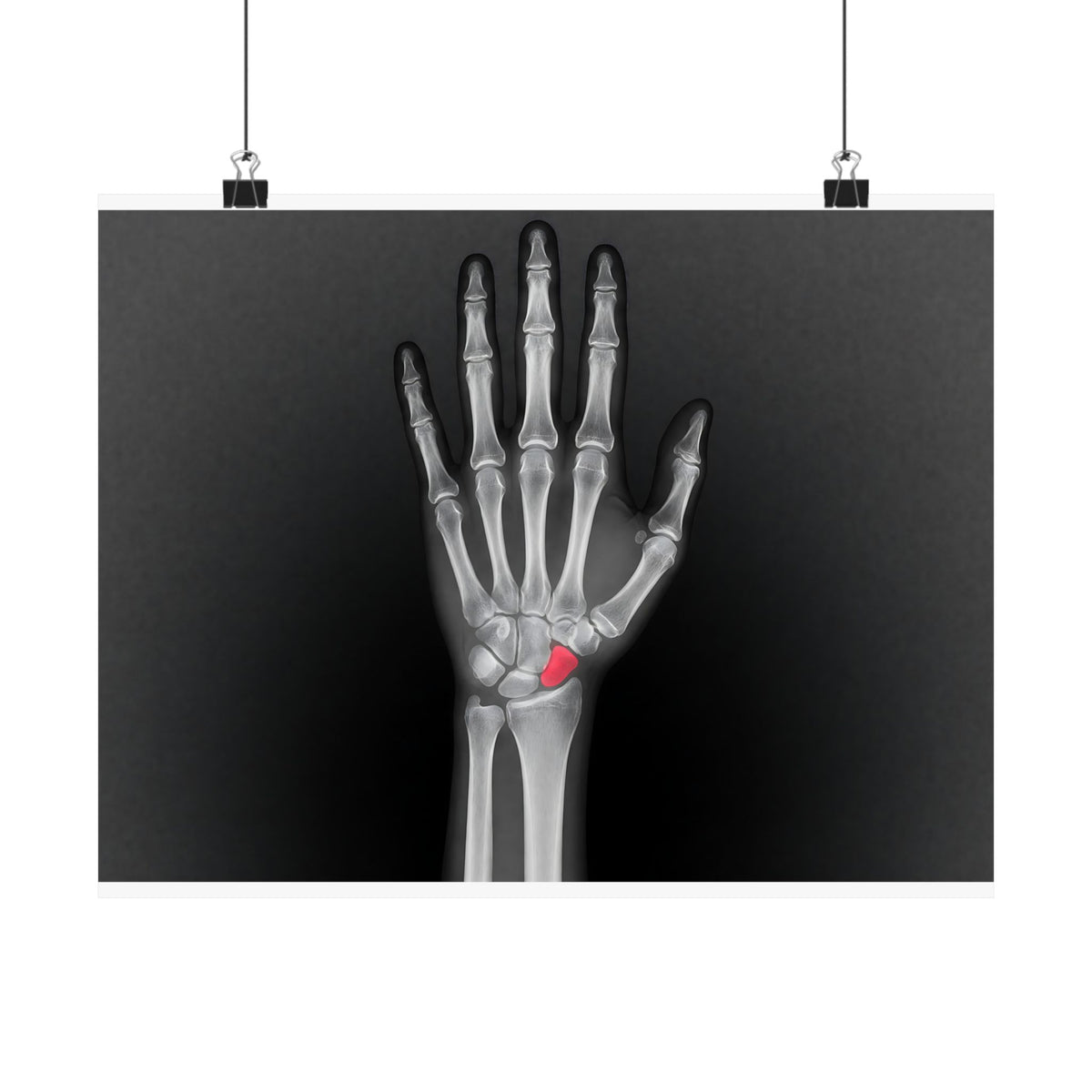 Carpal Study - Doctor's Office Wall Art | Matte Poster (Landscape)
