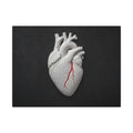 Coronary Path - Doctor's Office Wall Art | Canvas (Landscape)