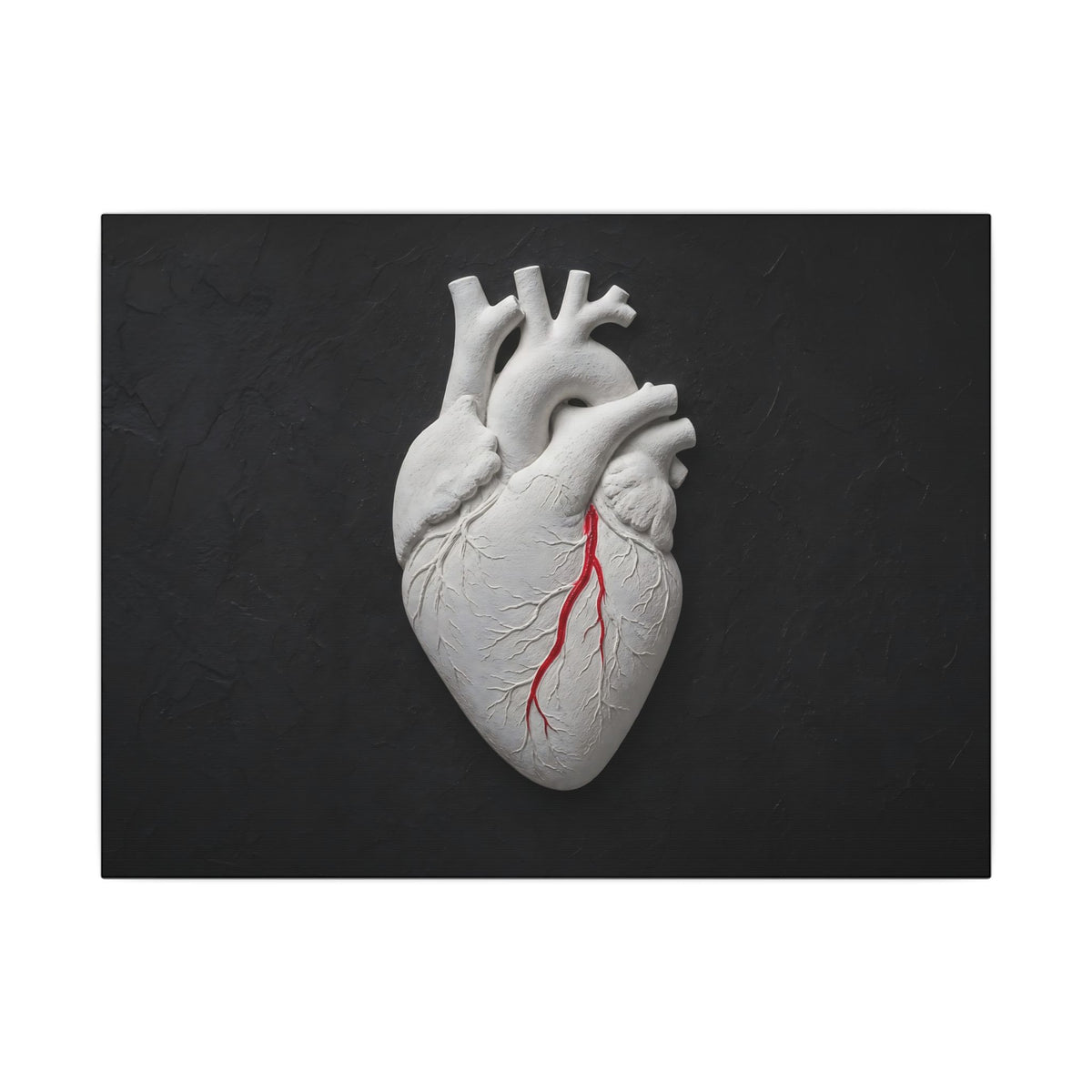 Coronary Path - Doctor's Office Wall Art | Canvas (Landscape)