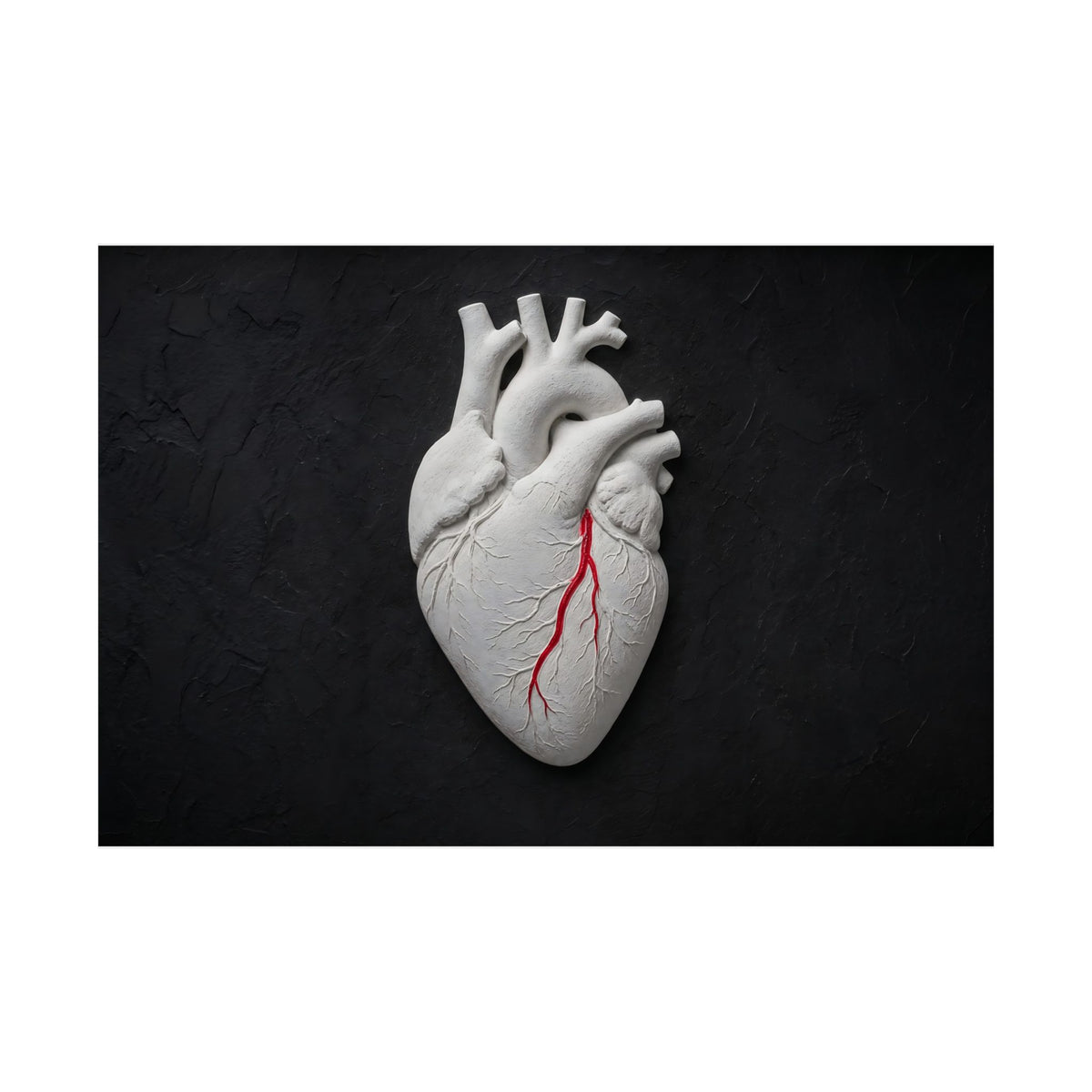 Coronary Path - Doctor's Office Wall Art | Matte Poster (Landscape)