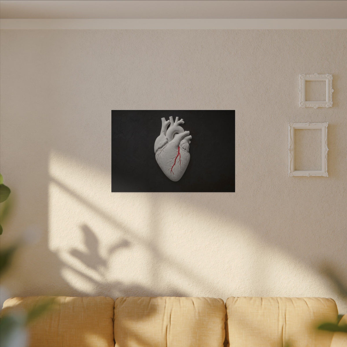 Coronary Path - Doctor's Office Wall Art | Canvas (Landscape)
