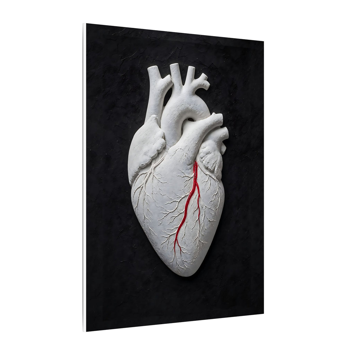 Coronary Path - Doctor's Office Wall Art | Canvas