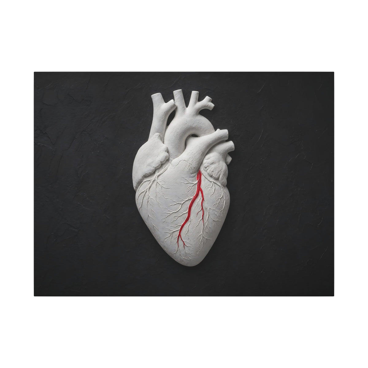 Coronary Path - Doctor's Office Wall Art | Canvas (Landscape)