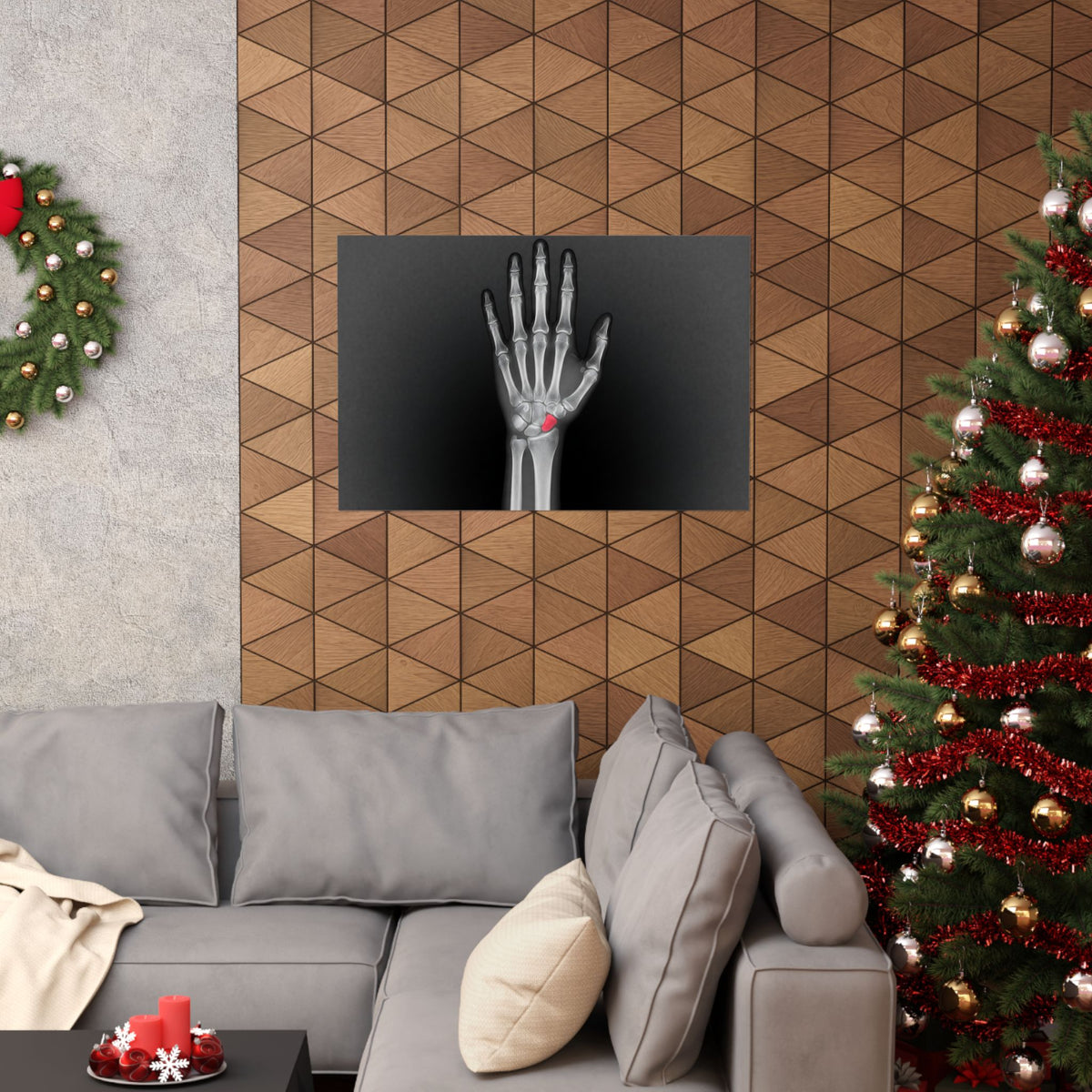 Carpal Study - Doctor's Office Wall Art | Matte Poster (Landscape)
