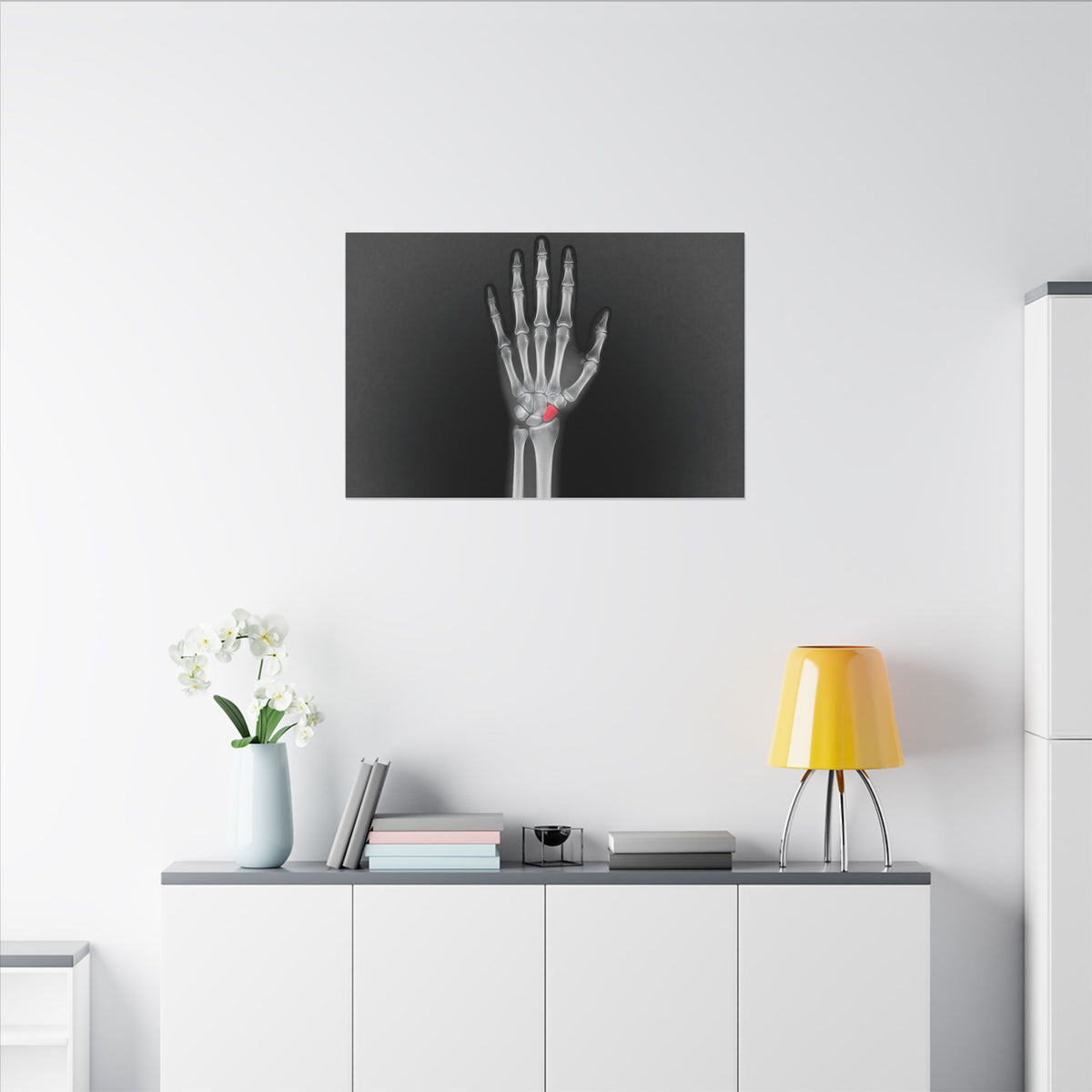 Carpal Study - Doctor's Office Wall Art | Canvas (Landscape)
