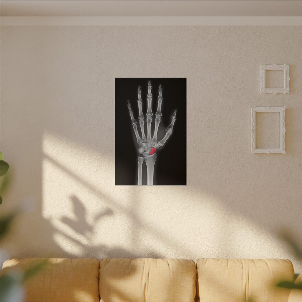 Carpal Study - Doctor's Office Wall Art | Canvas
