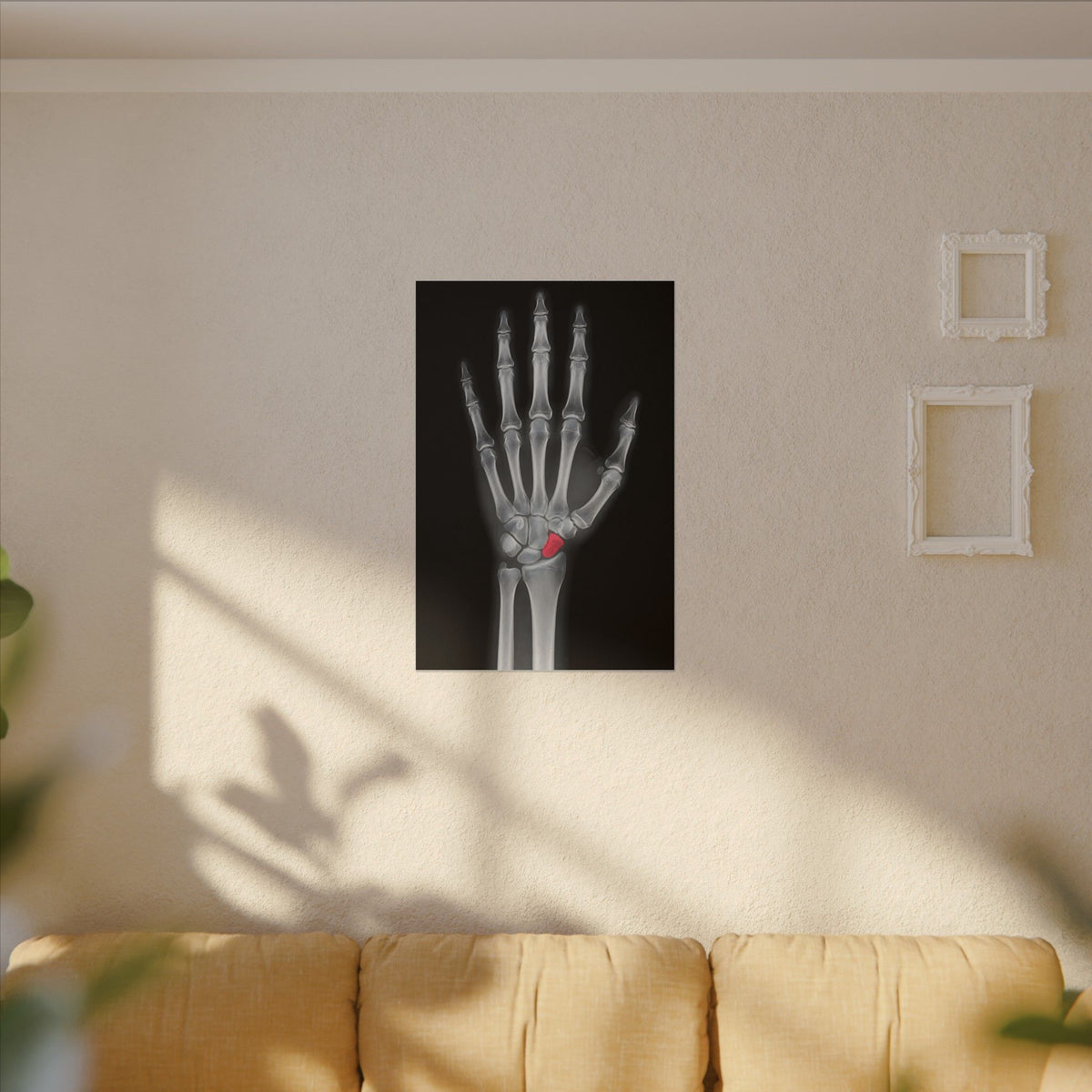 Carpal Study - Doctor's Office Wall Art | Canvas