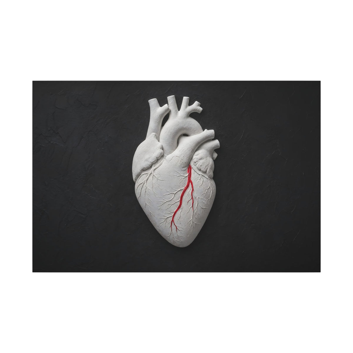 Coronary Path - Doctor's Office Wall Art | Canvas (Landscape)