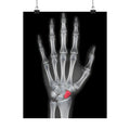 Carpal Study - Doctor's Office Wall Art | Matte Poster