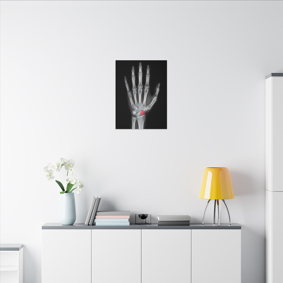 Carpal Study - Doctor's Office Wall Art | Canvas