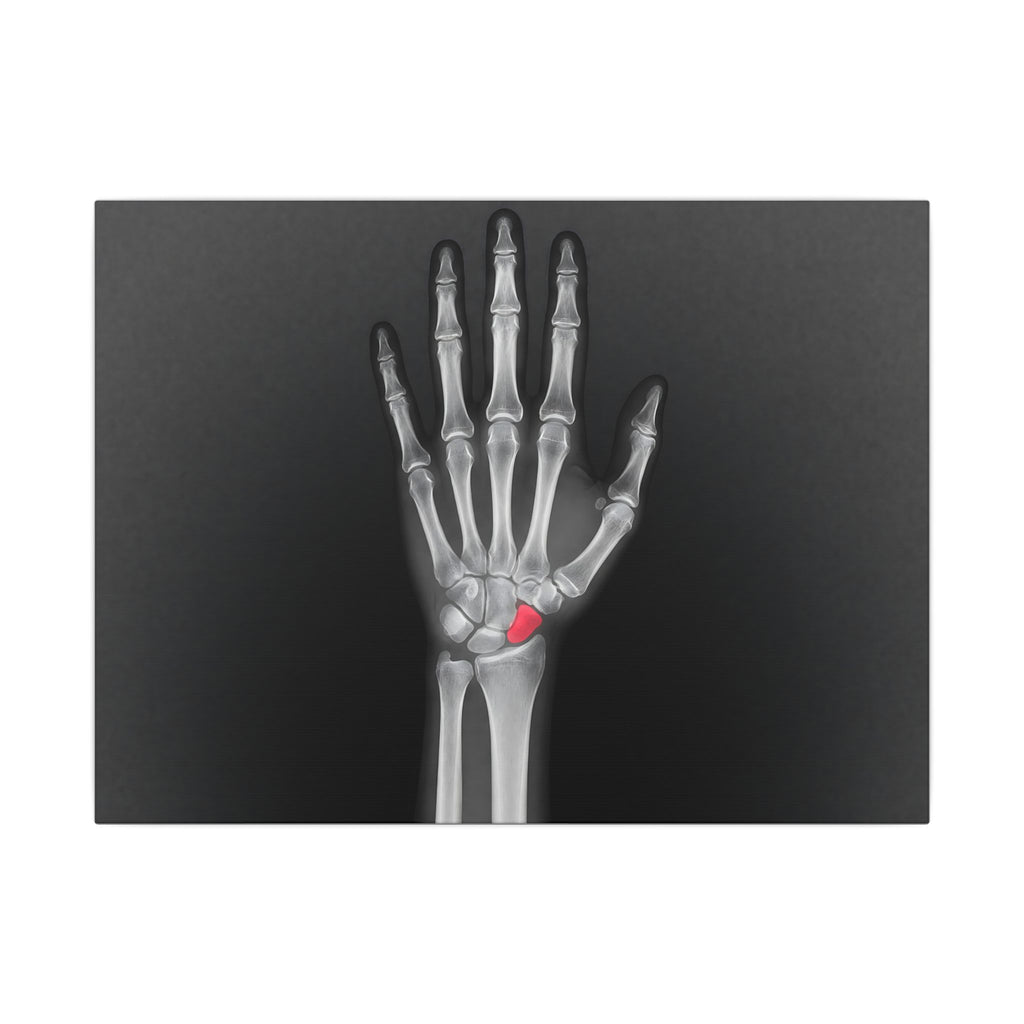 Carpal Study - Doctor's Office Wall Art | Canvas (Landscape)