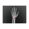 Carpal Study - Doctor's Office Wall Art | Canvas (Landscape)
