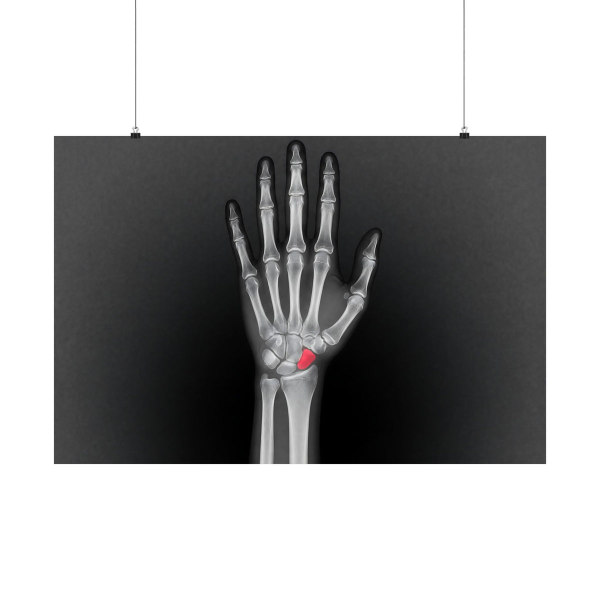 Carpal Study - Doctor's Office Wall Art | Matte Poster (Landscape)