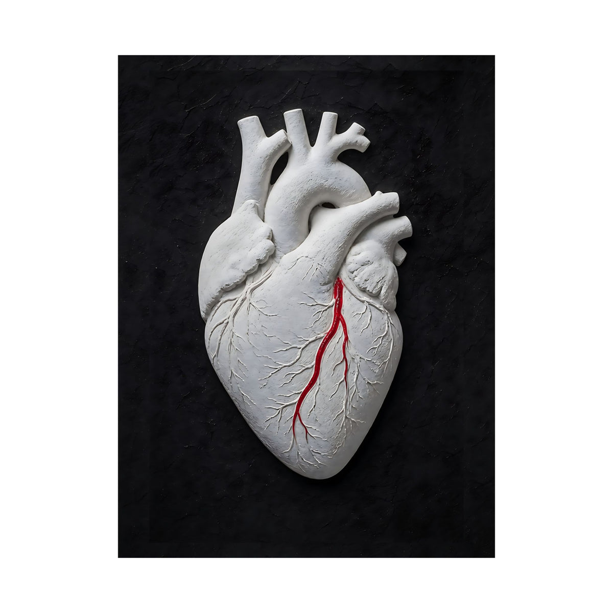 Coronary Path - Doctor's Office Wall Art | Matte Poster