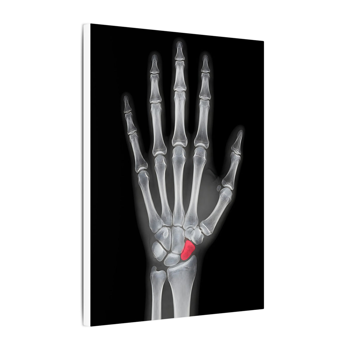 Carpal Study - Doctor's Office Wall Art | Canvas