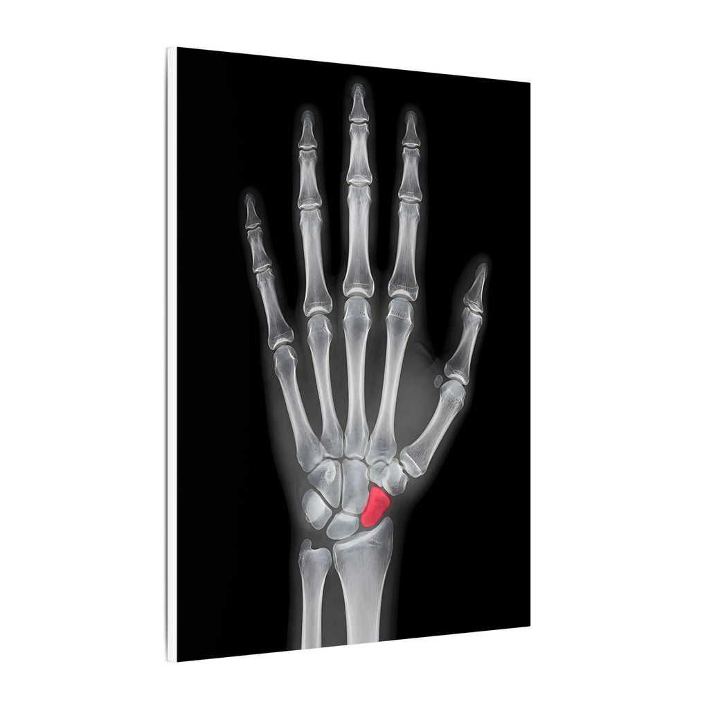 Carpal Study - Doctor's Office Wall Art | Canvas