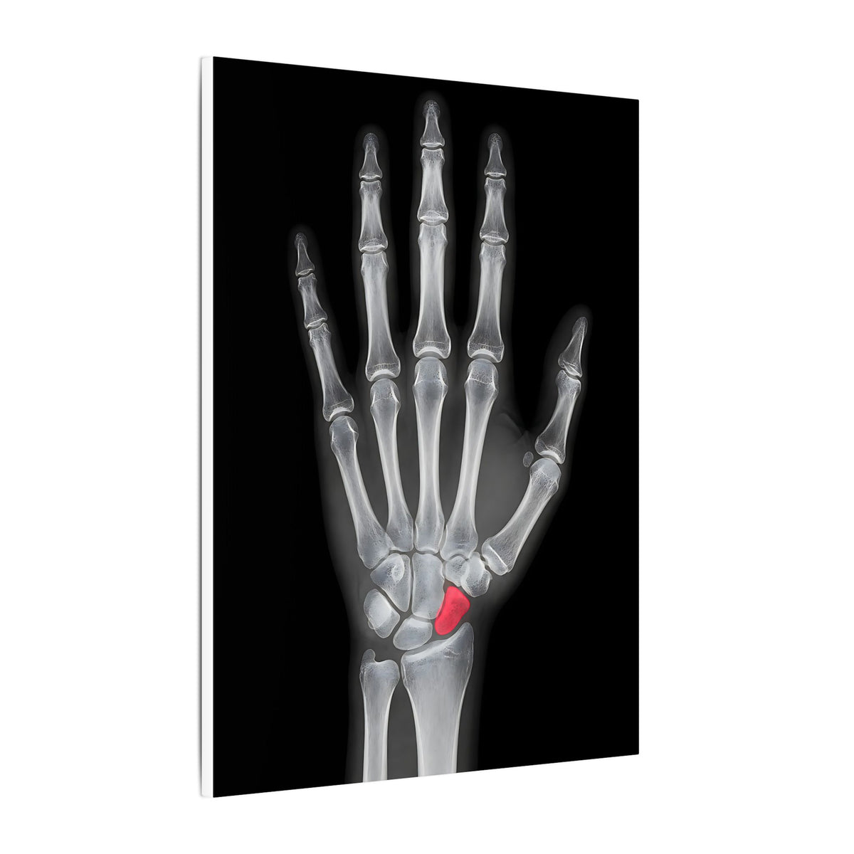Carpal Study - Doctor's Office Wall Art | Canvas