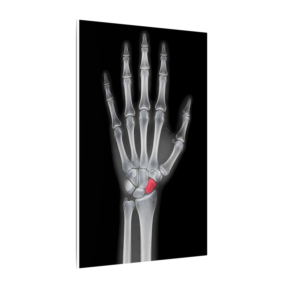 Carpal Study - Doctor's Office Wall Art | Canvas