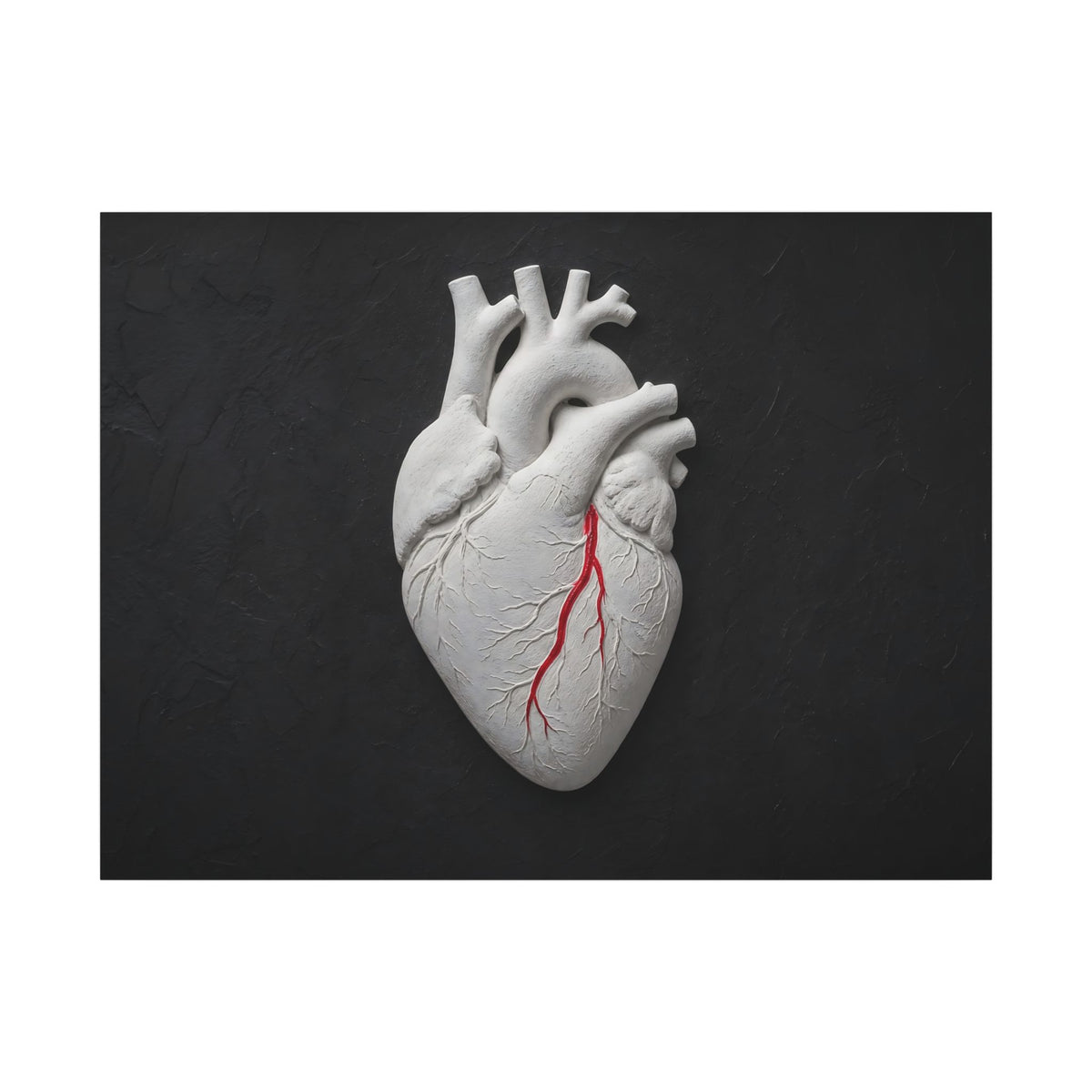 Coronary Path - Doctor's Office Wall Art | Canvas (Landscape)