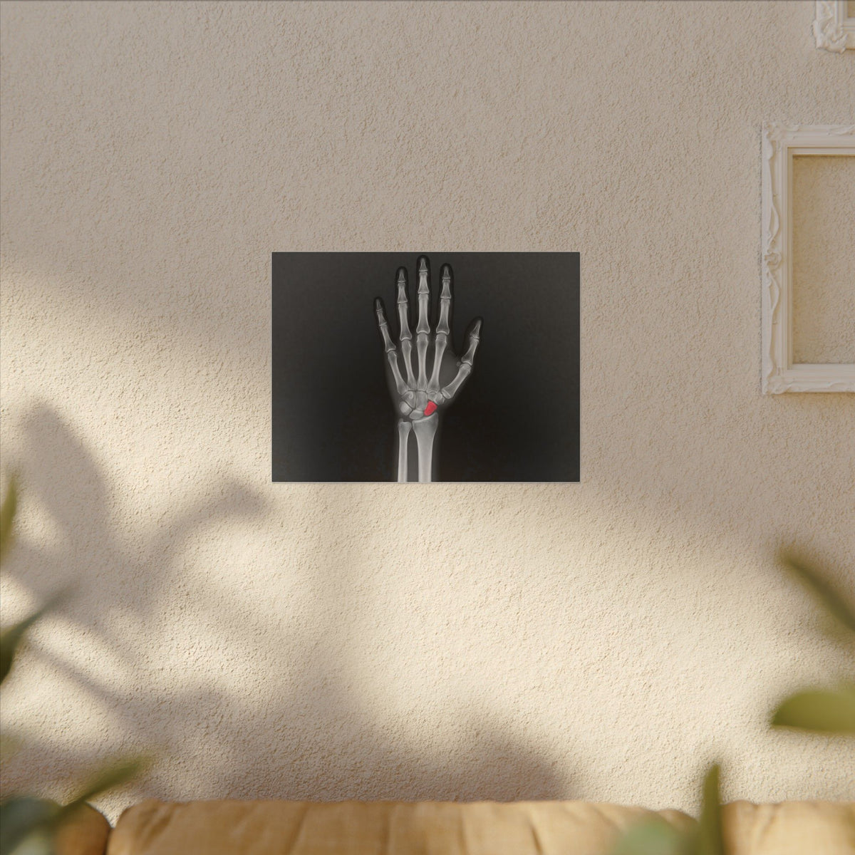 Carpal Study - Doctor's Office Wall Art | Canvas (Landscape)