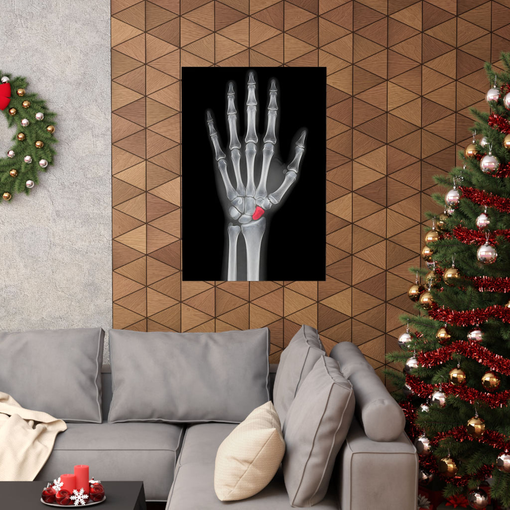 Carpal Study - Doctor's Office Wall Art | Matte Poster
