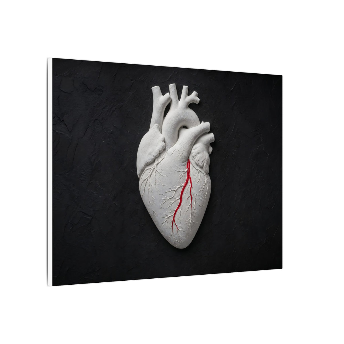 Coronary Path - Doctor's Office Wall Art | Canvas (Landscape)