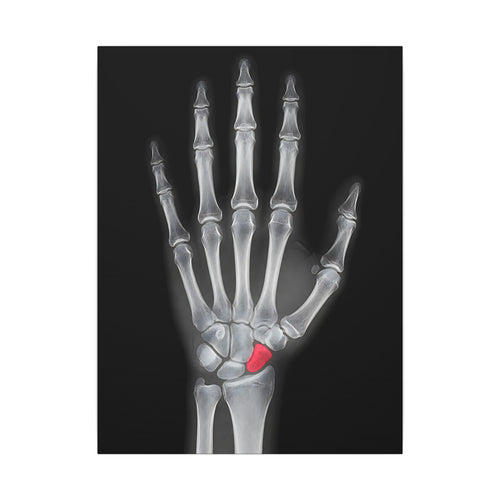 Carpal Study - Doctor's Office Wall Art | Canvas
