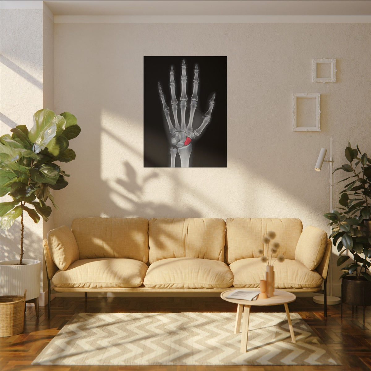 Carpal Study - Doctor's Office Wall Art | Canvas