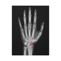 Carpal Study - Doctor's Office Wall Art | Canvas