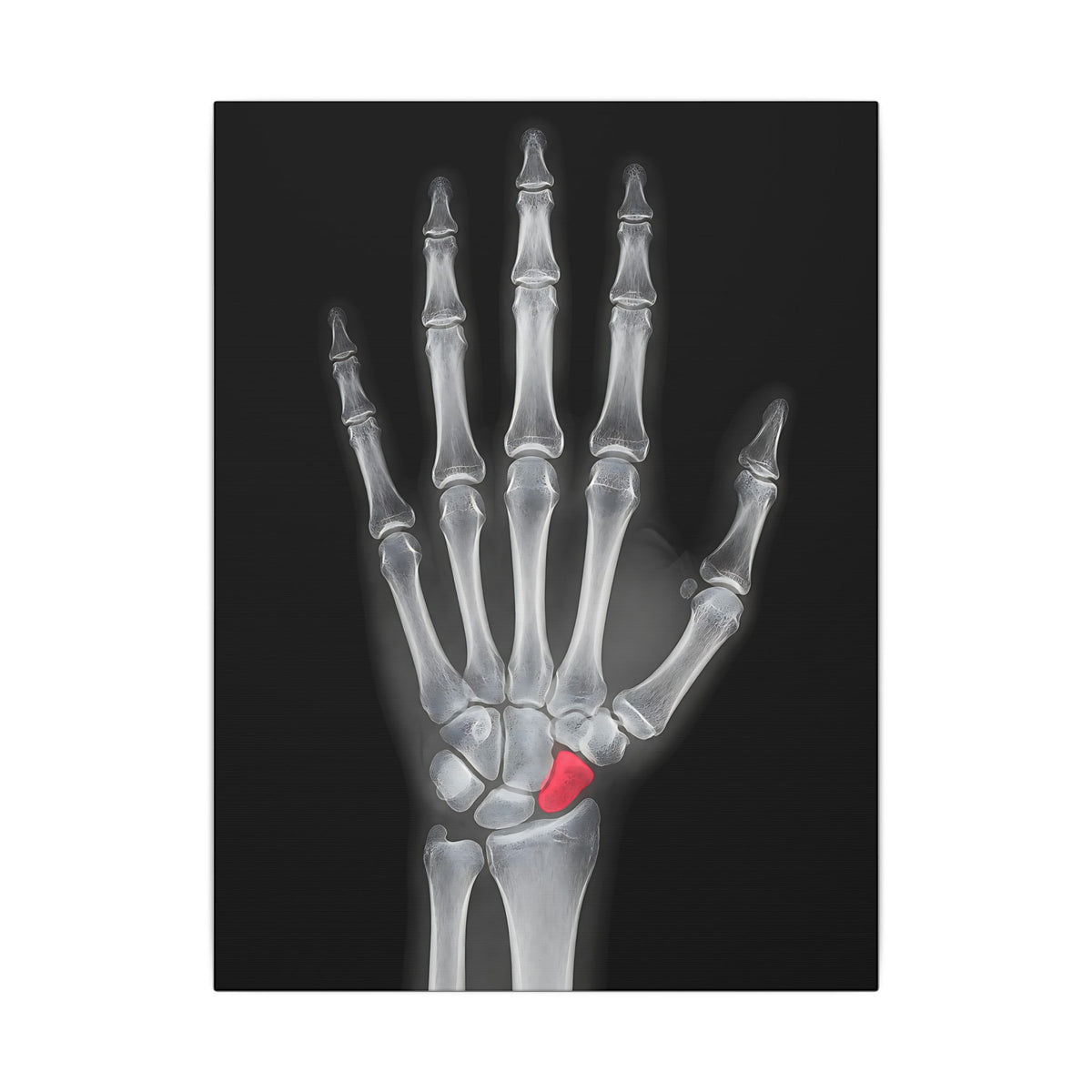 Carpal Study - Doctor's Office Wall Art | Canvas