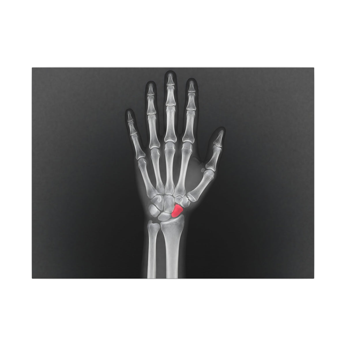 Carpal Study - Doctor's Office Wall Art | Canvas (Landscape)