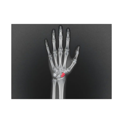 Carpal Study - Doctor's Office Wall Art | Canvas (Landscape)
