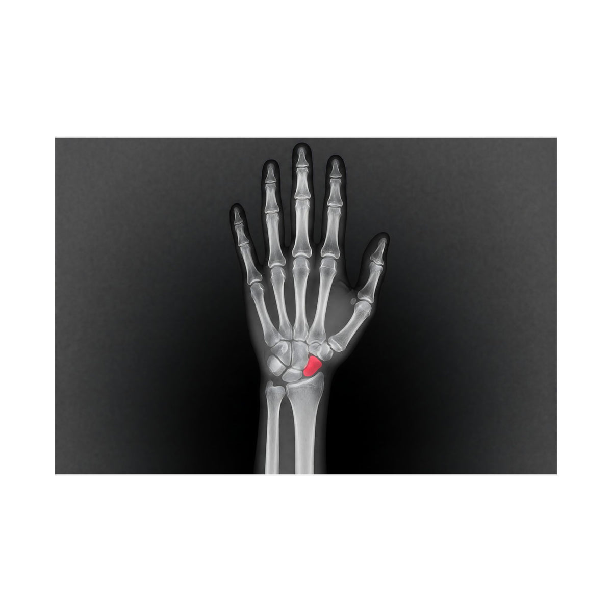 Carpal Study - Doctor's Office Wall Art | Matte Poster (Landscape)