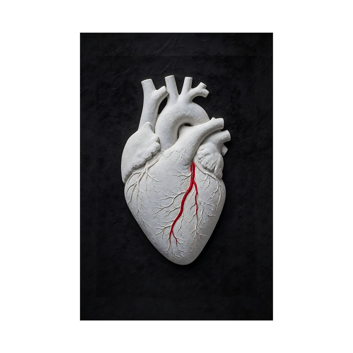 Coronary Path - Doctor's Office Wall Art | Matte Poster