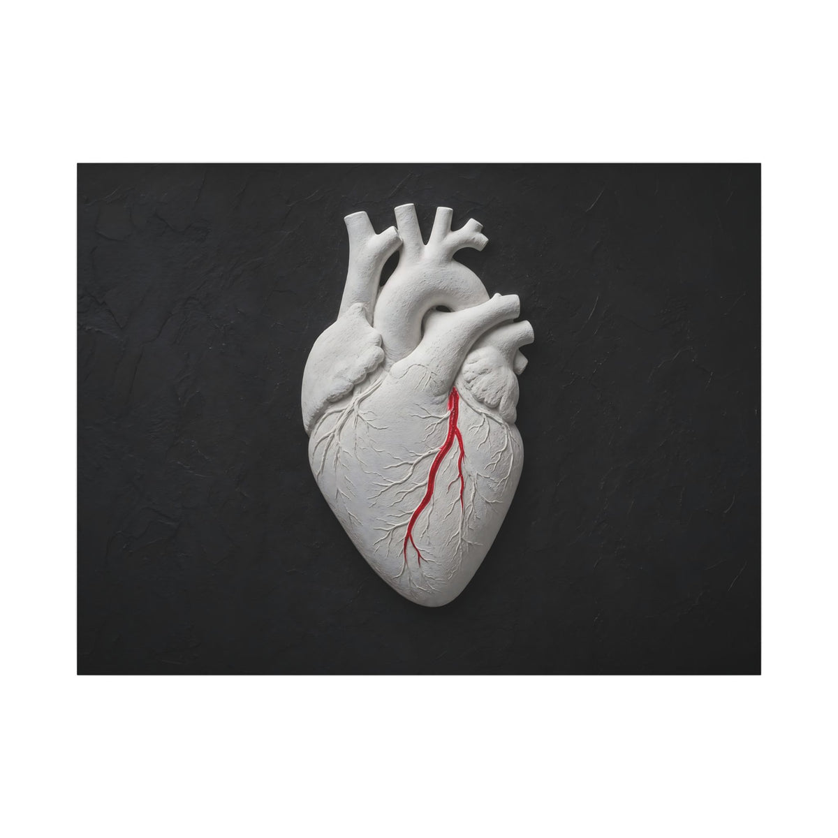 Coronary Path - Doctor's Office Wall Art | Canvas (Landscape)
